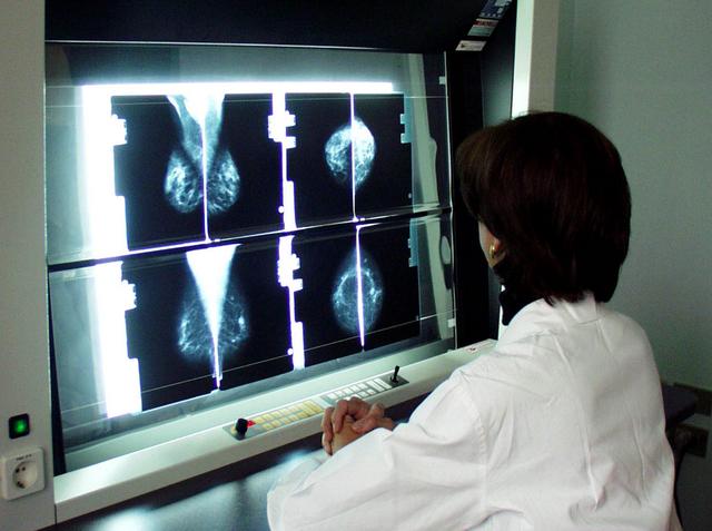 Tumore alla mammella:ottobre di prevenzione