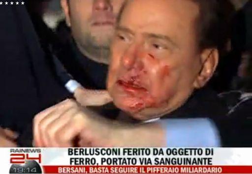 Berlusconi resta in osservazioneE’ in ospedale dopo l’aggressione