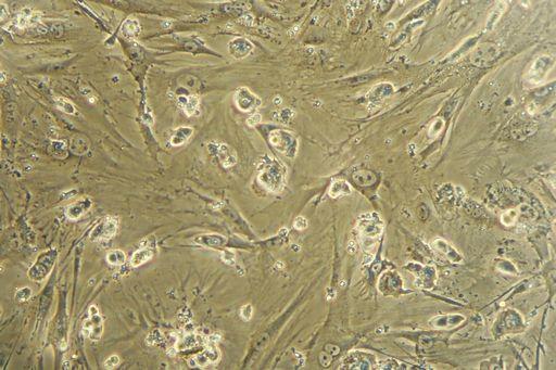 Parkinson, riprodottineuroni ammalati