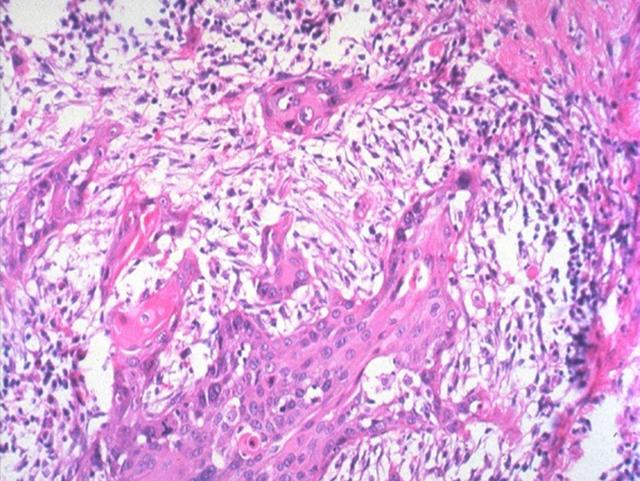Il cancro«in manette»
