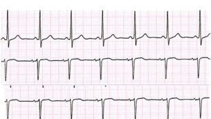 Cardiologiapro e contro