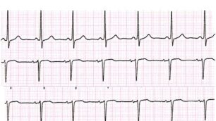 Cardiologiapro e contro