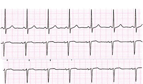 Cardiologiapro e contro