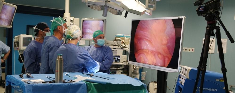 Desio, intervento di chirurgia totalmente laparoscopica per doppio tumore al colon