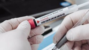 Coronavirus test sierologici