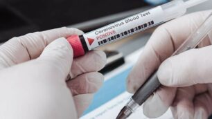 I risultati dei primi test sierologici in Regione Lombardia