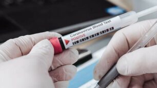 Coronavirus test sierologici