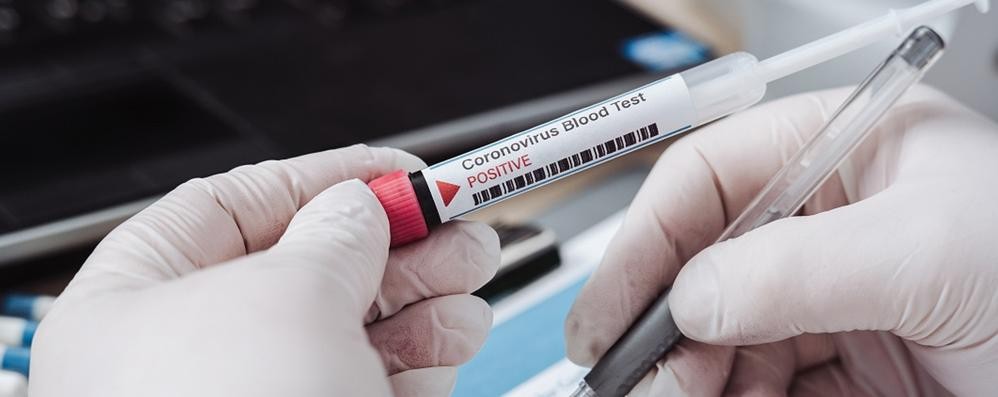 Un test per il coronavirus
