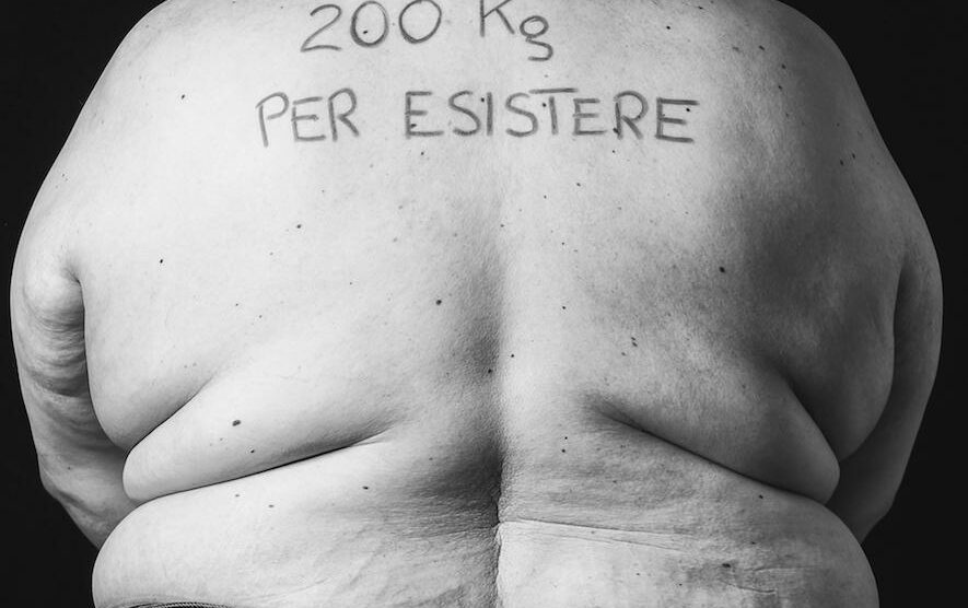 Una delle foto della mostra Io non esisto dedicata ai disturbi alimentari