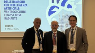 Fondazione Irccs San Gerardo TC con intelligenza artificiale. Da sinistra dott. Rocco Corso, presidente Claudio Cogliati, prof. Davide Ippolito