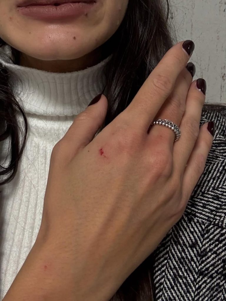 Ragazza aggredita sul treno per Milano PG